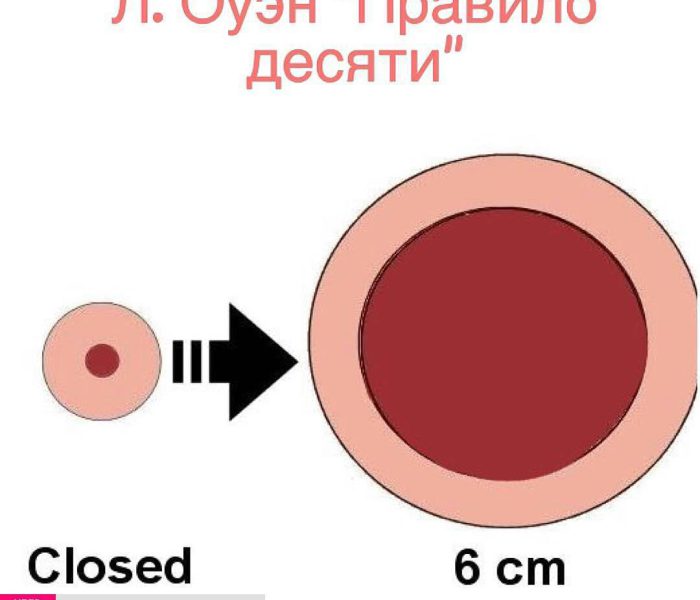 Правило десяти