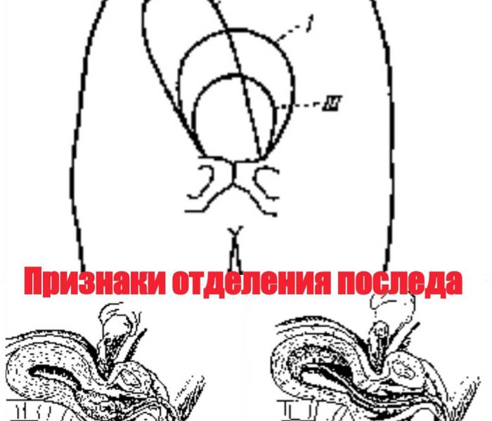 Тактика ведения 3 периода родов