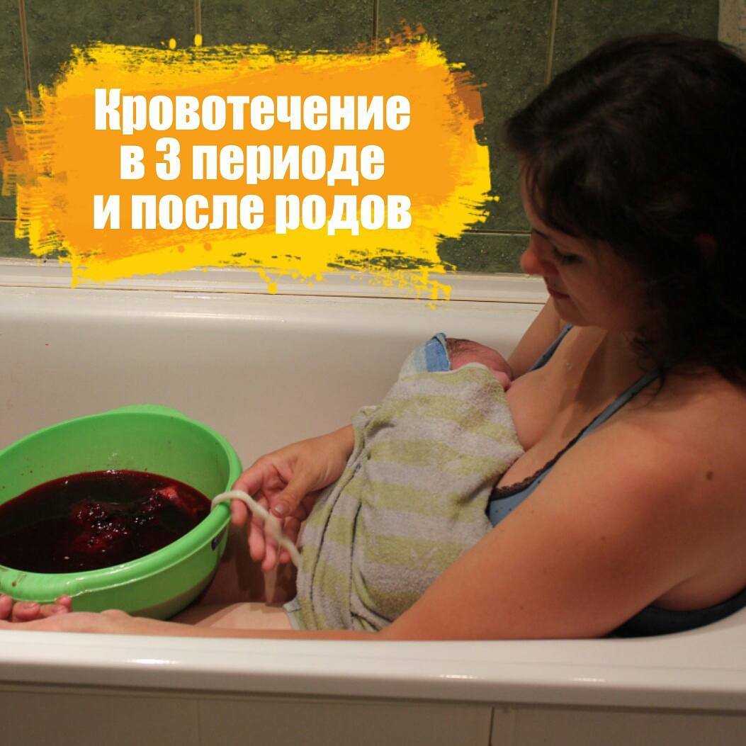 Помощь при  кровотечении