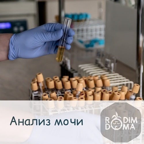 Анализ мочи