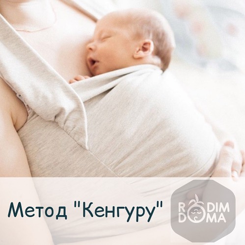 Метод кенгуру