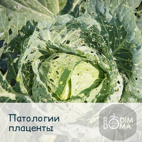 Патологии плаценты