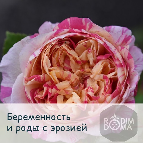 Беременность и роды с эррозией
